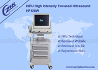 Máquina anti enfocada de intensidad alta de la arruga de Hifu del ultrasonido con efecto duradero